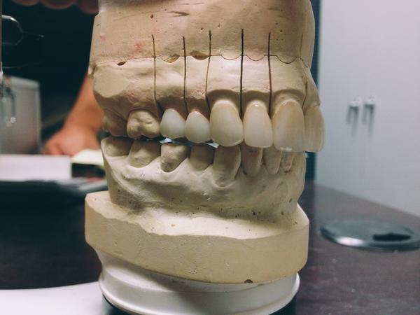 juneceramic's tweet image. #PicoftheDay - Inside our Dental Lab Studio! Check out one of our final products! juneceramic.com