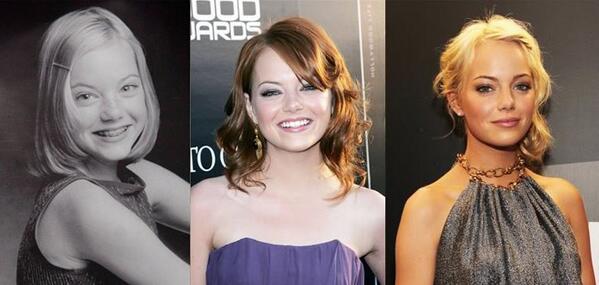 ThenNowWow's tweet image. Emma Stone