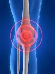 #Hoyaprendi  que cuando un paciente tiene sinovitis, debo pensar en un posible diagnóstico de artritis. <a href="/carvicab/">Carlo V. Caballero 🧬♥️</a>