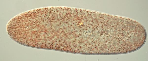 ulfjo's tweet photo. Anaperus rubellus from 50 m depth Sw coast 1 mm long live worm #marinebiology #invertebrates #Acoela #meiofauna http://t.co/9U1CbI04R6