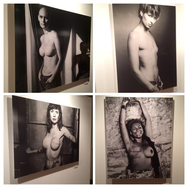 ShellyHorton1's tweet photo. The #SCARproject an empowering art exhibition. I'm proud I'm an @nbcf ambassador Thanks @julespeedee @healthyMEtvAU http://t.co/DRmi7nBWxX