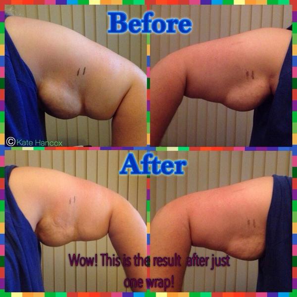 HancoxKate's tweet image. So here is the result from one of the lovely ladies at an Aloe Forever Party last night! WOW!!!