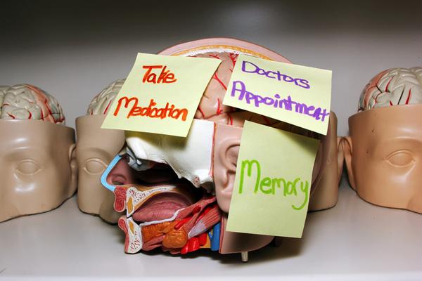 dailywildcat's tweet photo. Researchers clear up misconceptions about normal aging #WildcatScience http://t.co/VVwVD7TbwR http://t.co/zmBEv5q2Eb