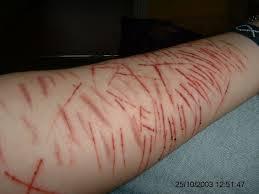 AddictsUnite's tweet image. Is Cutting an Addiction? Oh Yes &amp;amp; can be detrimental please check our webiste out addictsunite.co.za