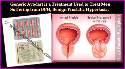 buy viagra without