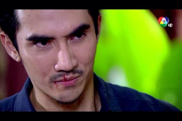 BigMClub's tweet photo. โอ้ยยย สงสารพี่คมจัง ..!!!!!! http://t.co/BXNG5SjHdG