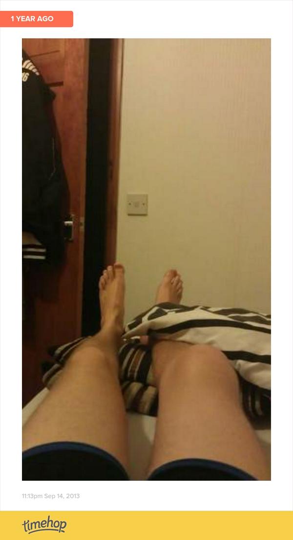 jakebush92's tweet photo. so a year ago this happened! #knee #injury #ligaments #snapped #seriously #swollen http://t.co/F9R7nJrx9T http://t.co/t6fDWp4g2F