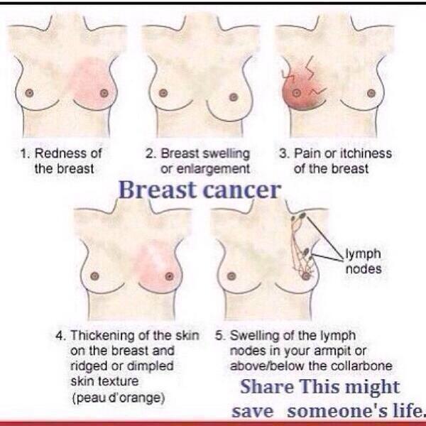 chothale's tweet image. एउटा आरटी र सेयरले सयौं ज्यान जोगिन सक्छ