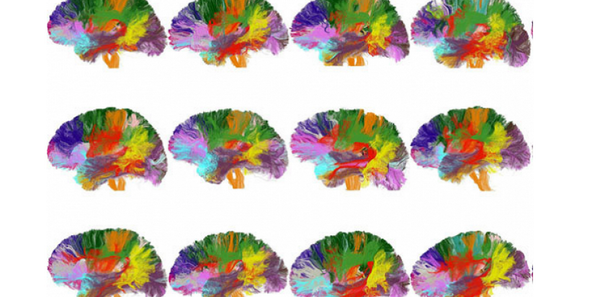 Matheo29's tweet photo. #C3RV34U, l’expo neuroludique de la @citedessciences, c'est demain et sur @Sciences_Avenir http://t.co/tt4Z0R3HeZ http://t.co/7nt3bUBCIk