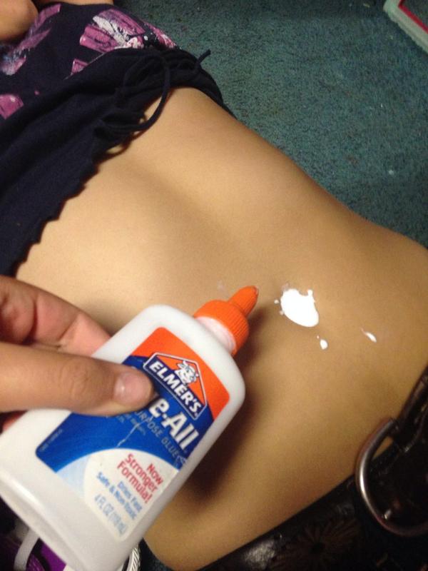 elmers glue for blackheads