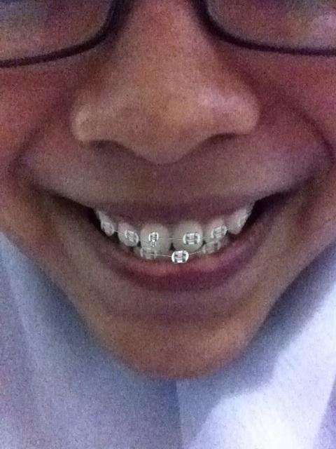 Edited using the Virtual Dentist iOS app.<a href="/tissarafifah/">Tissa</a>