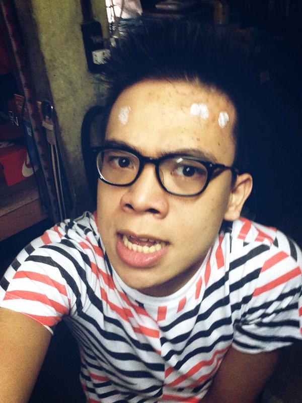 alendeyb's tweet image. #PimpleProblems 😒💢👊