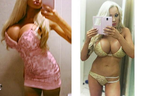 Daily Star on X: Glamour model with M-cup boobs wants them even