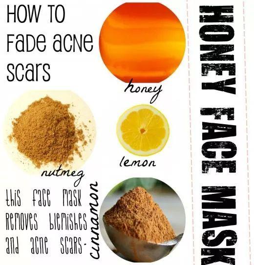 DayBoosterID's tweet photo. Kandungan gula yang berlebihan bisa menyebabkan jerawat. Atasi jerawat dengan masker madu dan lemon ini yuk. http://t.co/0lHVbmUFba