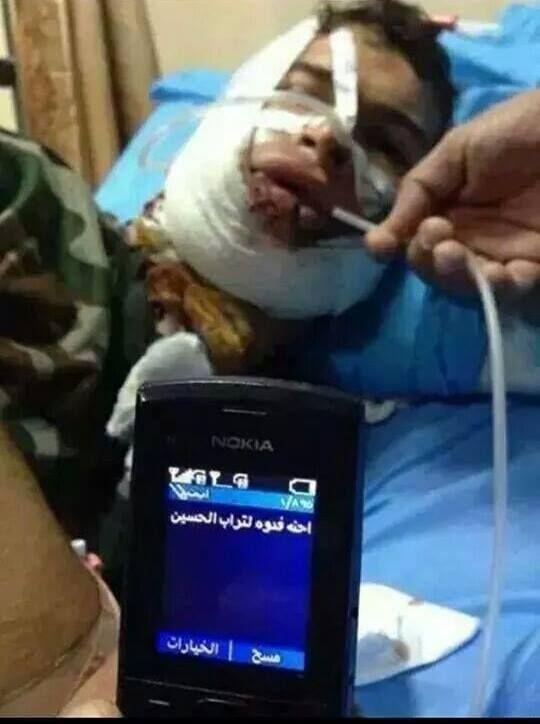 AHLULBAYT_TV's tweet photo. عراقي جُرح في الجهاد ضد عصابات داعش فلا يستطيع التكلم ولكن إقرأ ما كتبه على شاشة هاتفه النقال:

#العراق_مقبرة_النواصب http://t.co/JBsVf02Mtn