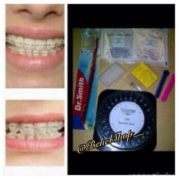 BehelShop__'s tweet photo. PROMO!! Behel Permanen Transparan Usa dari 650 rb-> 450 rb aja, Lengkap + FREE ONGKIR! Order? Cuss sms 08981060123;) http://t.co/4YwzbVzx5k