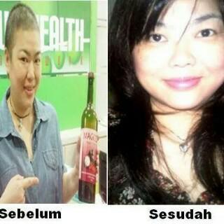 Sembuh dari kanker getah bening, wasir dan kanker rahim....luar biasa unihealth...7fa39bff...