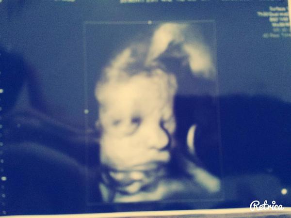 Tj N Chelsey  tweet media