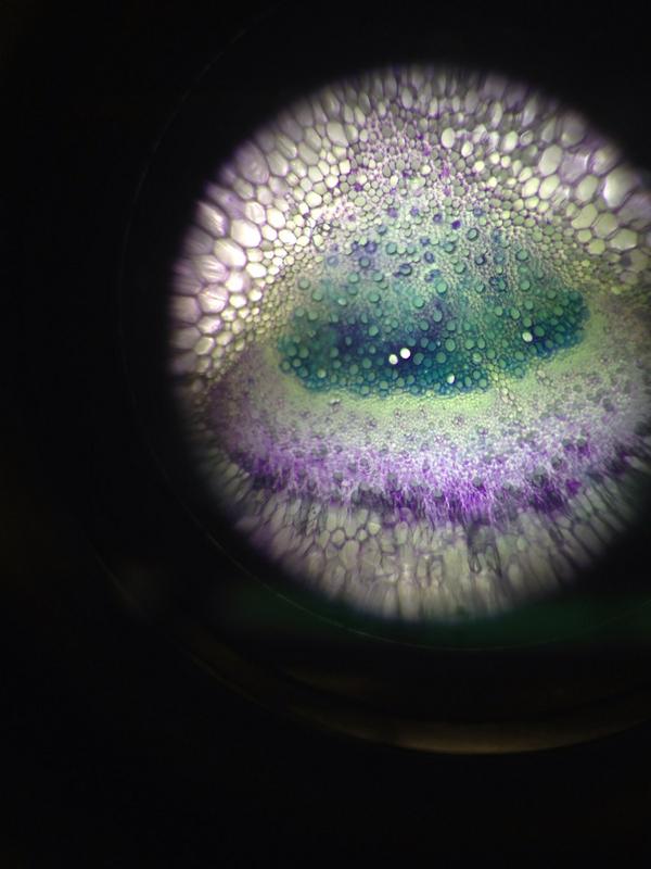 Celery Xylem And Phloem Under Microscope - Micropedia