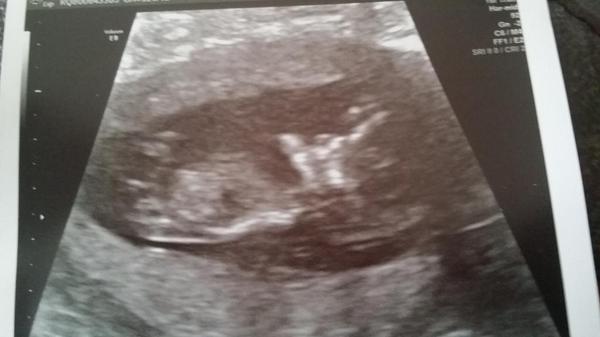 Claret2KFC's tweet photo. Over the moon I gonna be a daddy for firsy time. In words of the late aeddieG. #ImThePapi #BigDaddyCool #2KInTheClub http://t.co/EJPUyhyhau