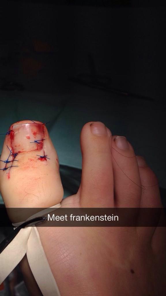sandradejin's tweet photo. Att inte kunna gå och bara vara sängliggandes är ytterst deprimerande http://t.co/bSpkRSGuj5