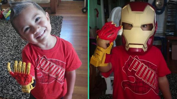 ChoiceFineArt's tweet photo. 3yr Old Boy born without fingers receives #IronMan #3Dprintedhand!
#Marvel #TeamBubba
http://t.co/Gn8Ua4AgSN http://t.co/tea7FNPtyK