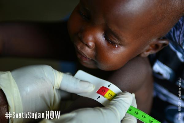 UNICEF's tweet photo. #SouthSudan: Tens of thousands of children at risk of death from #malnutrition http://t.co/ahZP2QViuR #SouthSudanNOW http://t.co/KL9GsRMvNE