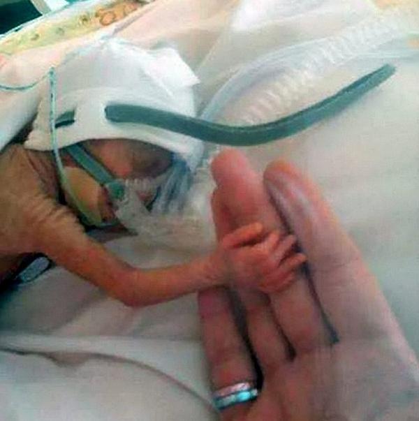 hazteoir's tweet photo. Una #bebé nacida a las 24 semanas evidencia la cruel falsedad del #aborto: http://t.co/jluFSkjtlP #LaVidaEsLoPrimero http://t.co/AbJEpfD0BU