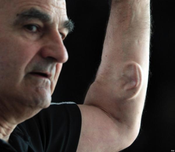 C0NDUCTR's tweet image. Performance artist Stelarc is growing a left ear on his left arm. #CoffeeBreak #ThirdEar #WTF  #BodyModification