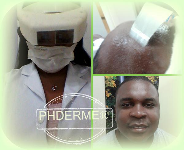 _phderme's tweet image. #Estética #amoroquefaço#superenvolvida #profissionalespecializada #Copacabana  #tel39035271 #celwatsapp997326990