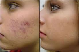 BIO SPRAY GOLD tweet media