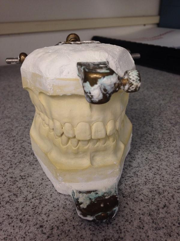 LFHSAdviseTX's tweet photo. Check out what students make in Dental Lab Technology @TSTCHarlingen #counselorupdate http://t.co/XRj5aBCg7B