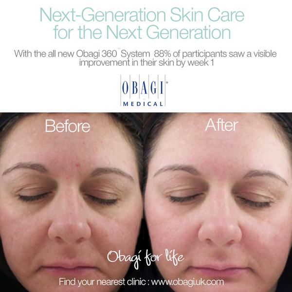 ObagiUK's tweet photo. After 1 week of using #Obagi360 88% of participants skin was visibly improved!
Find stockist: http://t.co/UKM1xMBMfn http://t.co/THqc0cwi5f