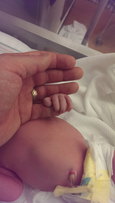 cemerick's tweet image. say 'hi' to Elizabeth and Olivia, two new siblings sharing a common causal history