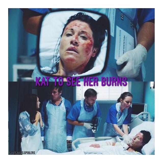 Happy birthday to jessie wallace kat will ask to see her burns for the first time tonight  