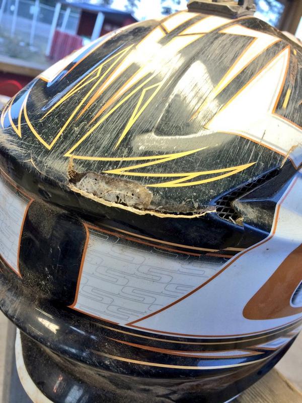Practiced today , crashed and hit my head in the ground. Maybe it is a mild concussion or something!!😔✊