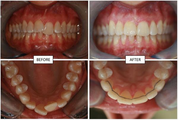 Triple O Dental Lab tweet media