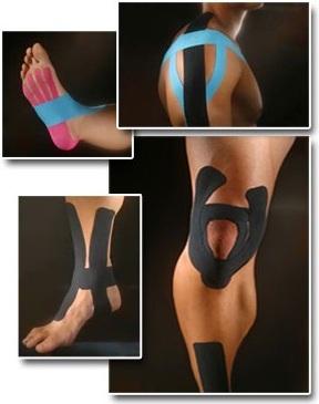 Talk to us about the benefits of K Tape! #support #swelling #kttape