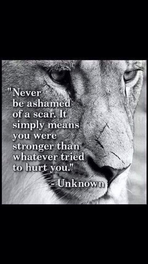 Never be ashamed of a scar..