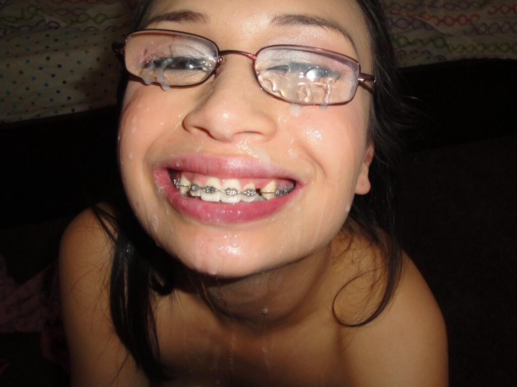 teens-with-braces-cumshot