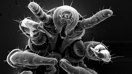 CBCNews's tweet image. Head lice have developed high rates of resistance to the treaments that dominate the market ift.tt/1ruvOLX