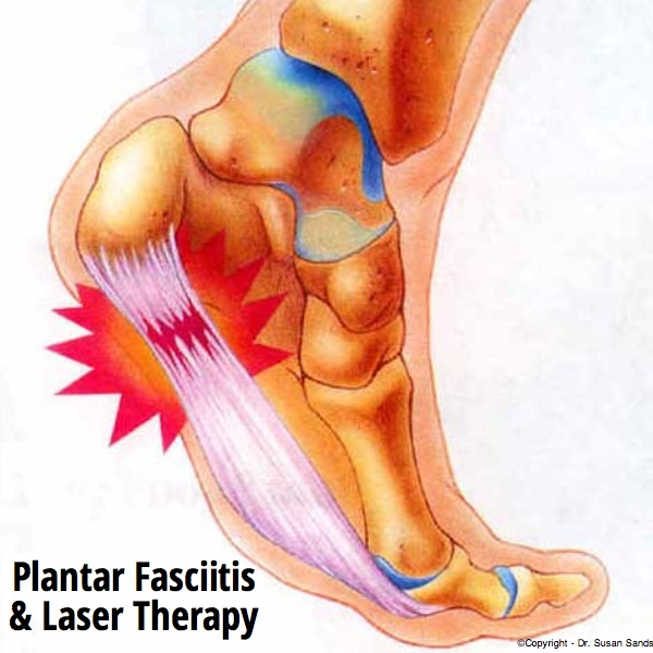 DrSusanSands's tweet photo. During each painless treatment, laser energy increases circulation, drawing water, oxygen and nutrients to the... http://t.co/ScQySgRReD