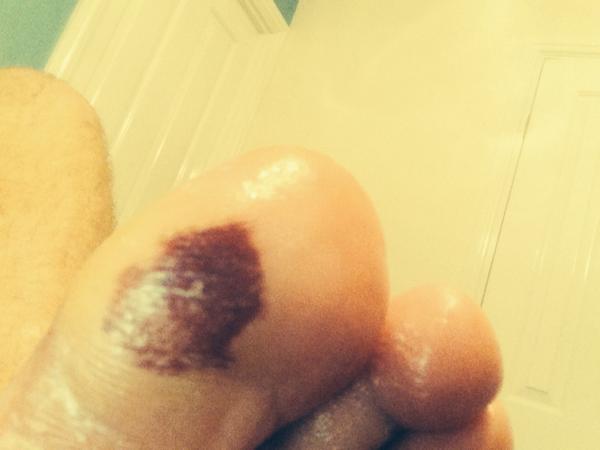 wils82's tweet image. Same on the other foot 2 #ouch #hardground
