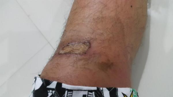 Ini pasti akting kan ya bang ? "<a href="/hardifadhillah/">hardi fadhillah</a>: Hari ke 4 ""