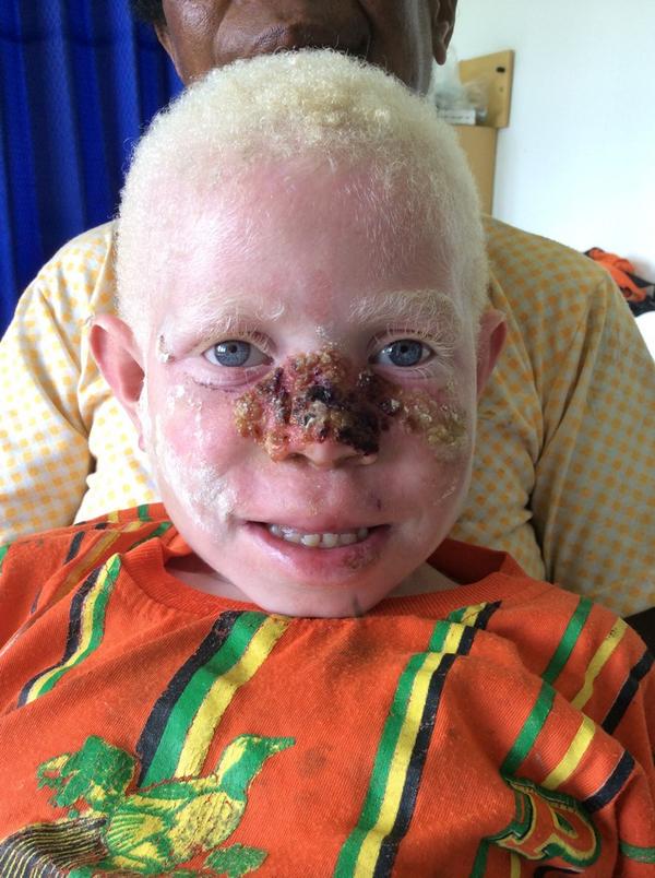 soalUKDI's tweet photo. Diagnosis? http://t.co/PQ3Qrvec3B