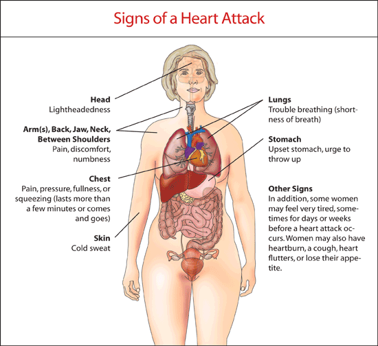 womenshealth's tweet photo. RT THIS. You know what a #heartattack looks like, right? WRONG. http://t.co/DGNQGm10N1 http://t.co/Uod1mCCPbD