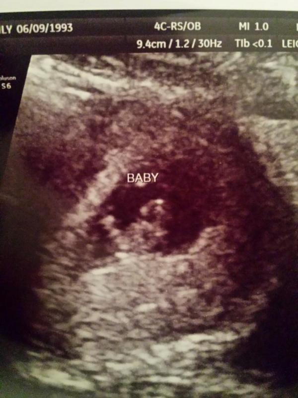 Our little peanut