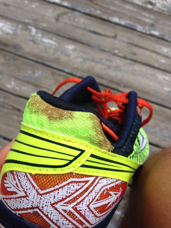 CanadianRunProb's tweet image. #RunnerTips never wear spikes sockless UNTIL you've broken them in #BloodStains #xcnation