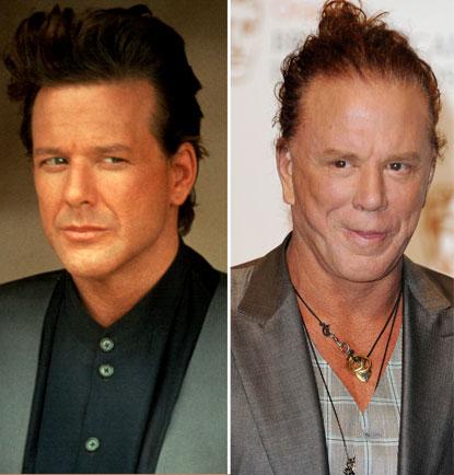 TwittelPacks's tweet photo. The 13 Most Shocking Celebrity Plastic Surgery Transformations  http://t.co/rUkhRXMUqF http://t.co/EhOaBRthBC