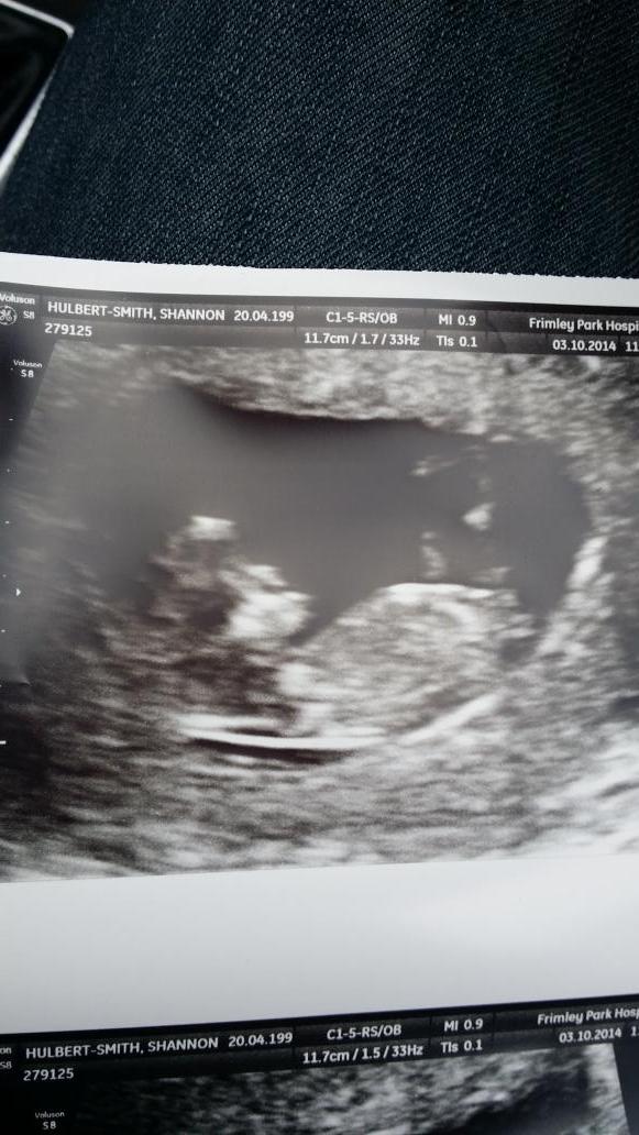 JWilson414's tweet photo. @ShannonHsx looks like im gunna be a dad #DaddyWilson http://t.co/OihYtw4kna
